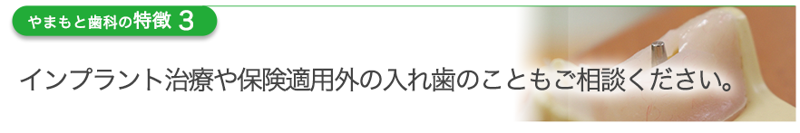 インプラント治療や保険適用外の入れ歯のこともご相談ください。